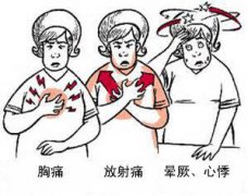 冠心病有哪些癥狀？