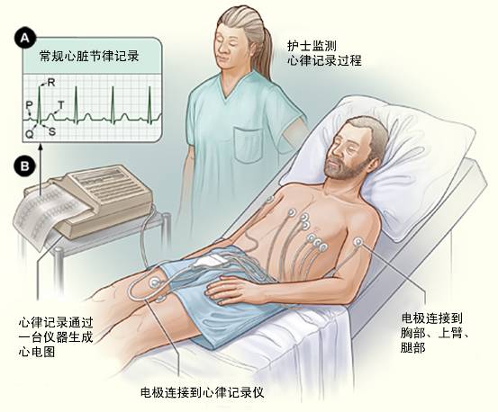 冠心病需要做哪些檢查？(圖1)