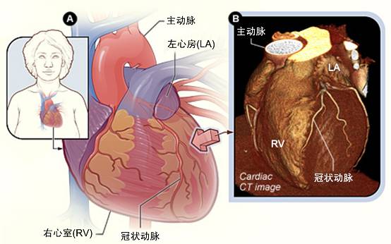 冠心病需要做哪些檢查？(圖2)