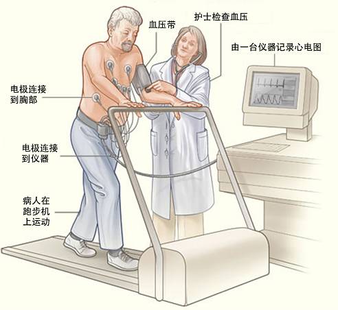 冠心病需要做哪些檢查？(圖3)